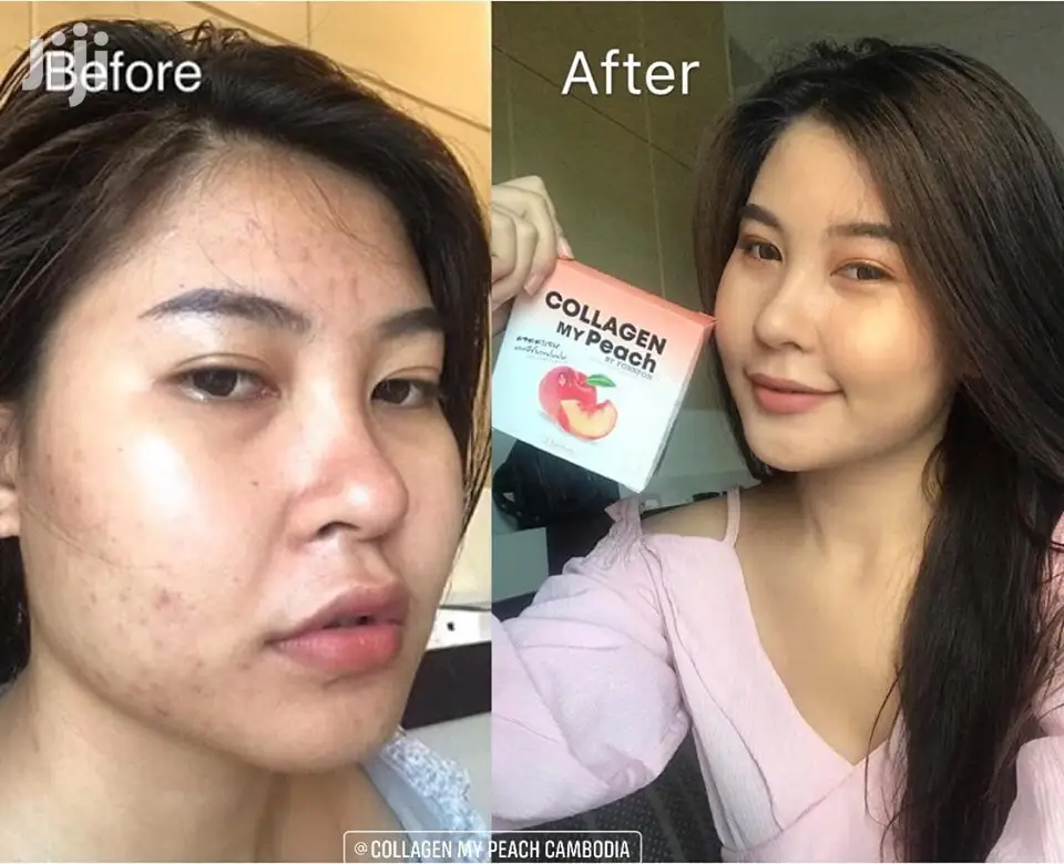 Collagen My Peach