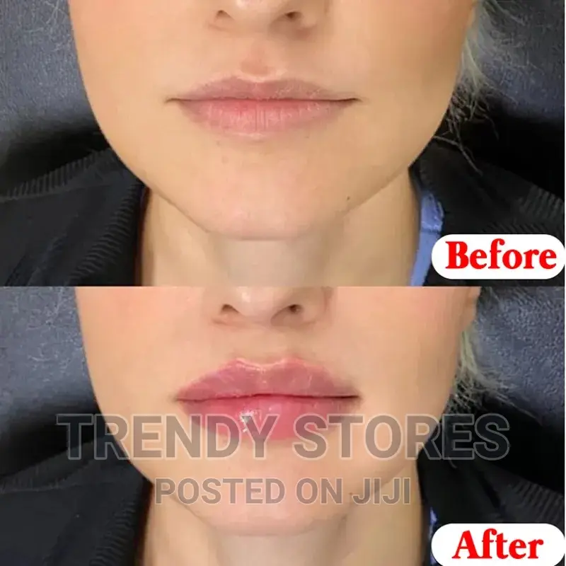 Moisturising Lip Balm