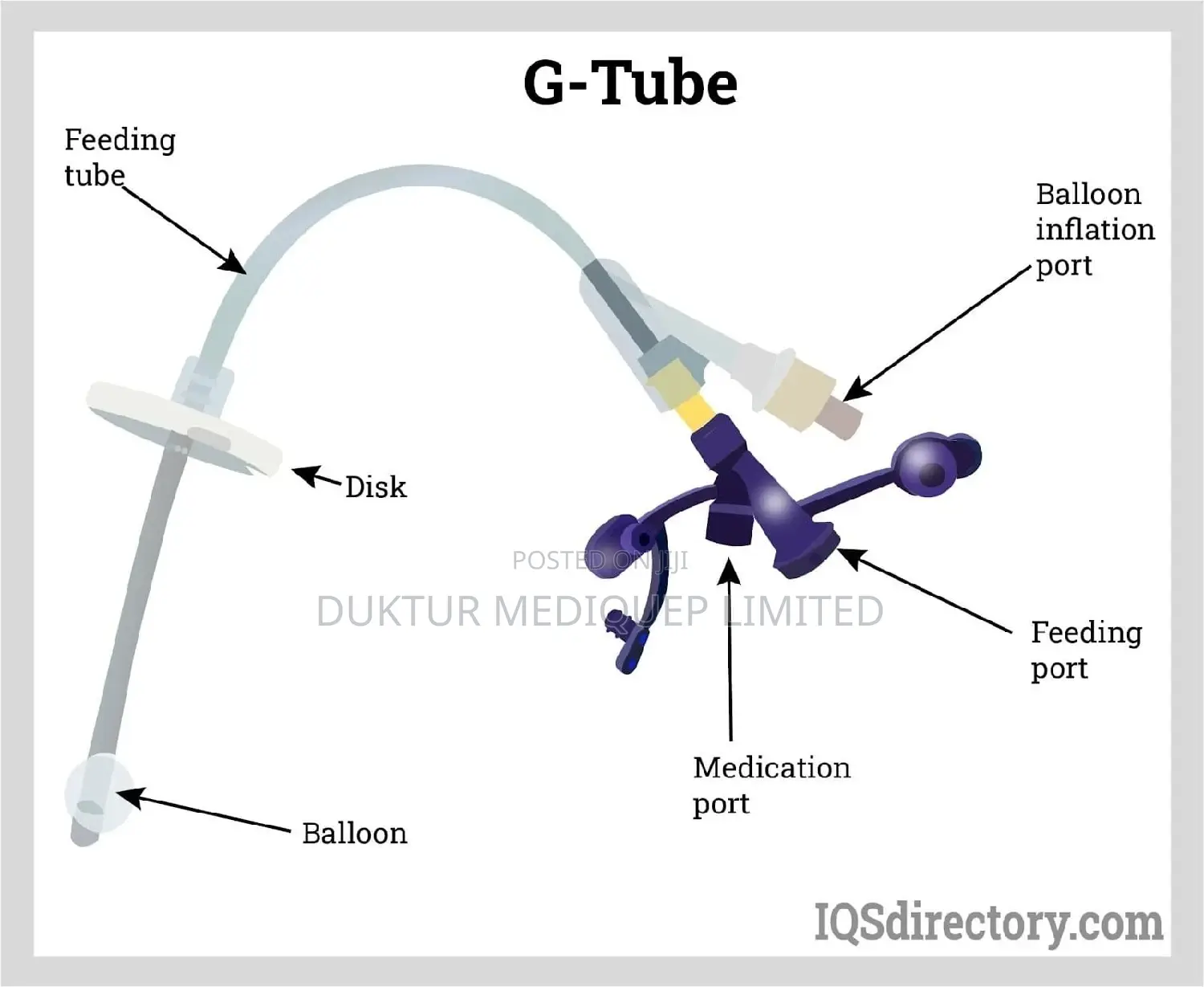 G-Tube/ Gastrostomy Feeding Tube