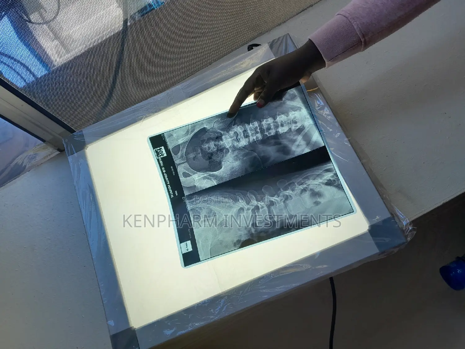 Medical Led X-ray View Box