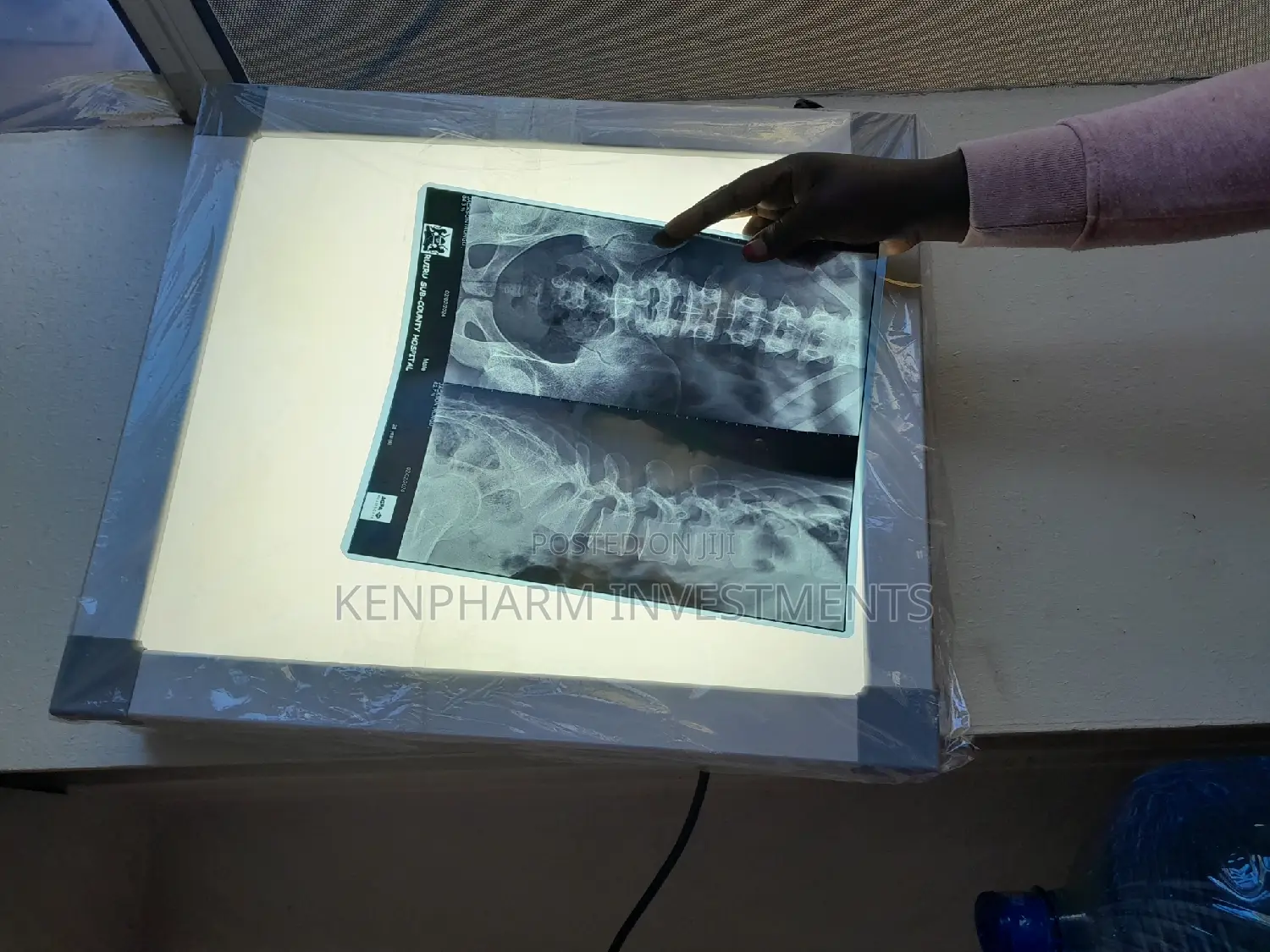 LED Xray Film Viewer Box Single