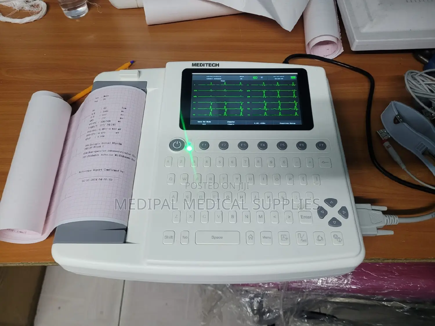 12 Channel ECG