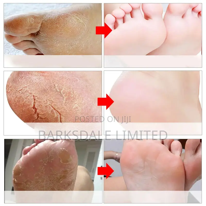 Foot Mask Feet Peeling Exfoliating Remove Dead Skin Pedicure