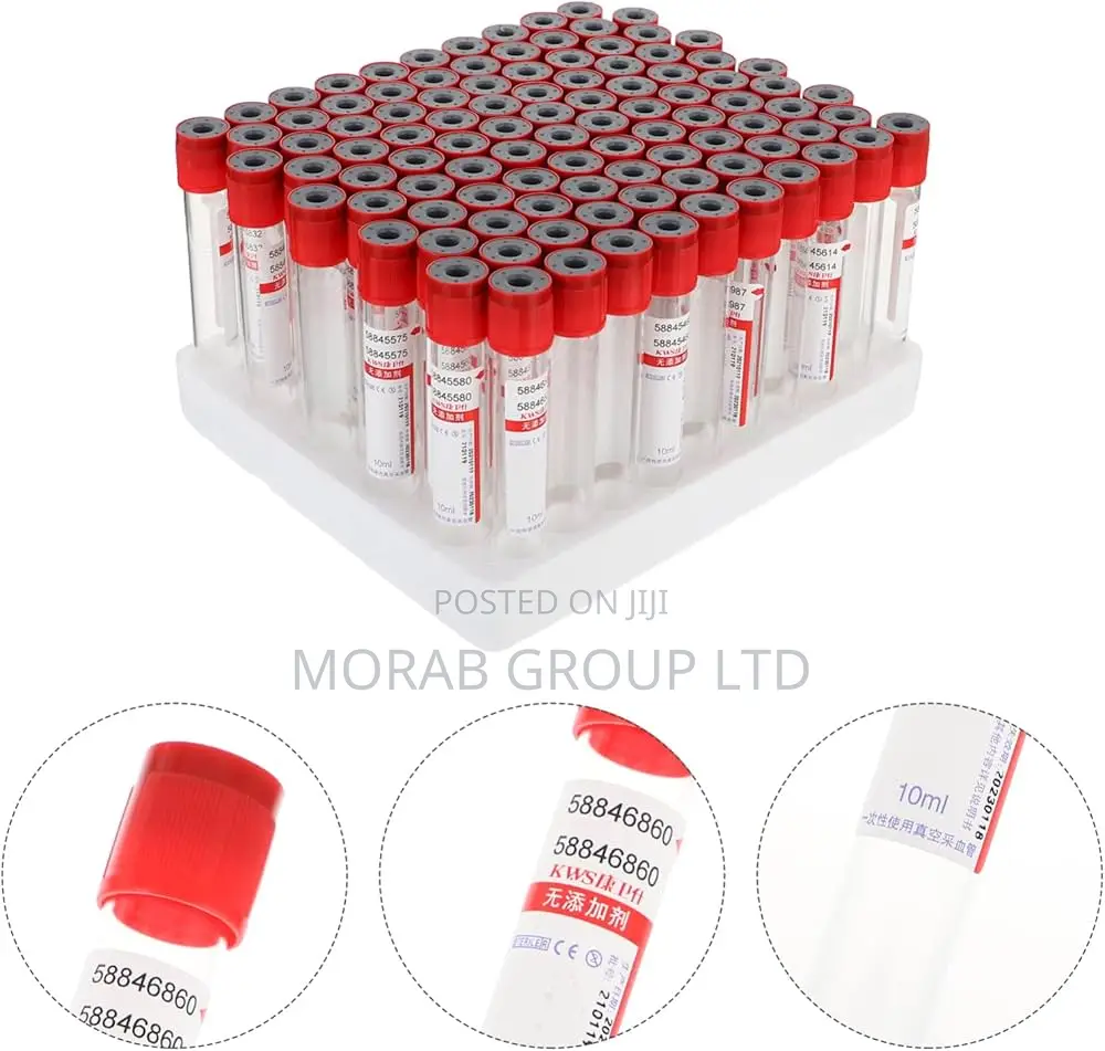 Vacutainer- Red Tops