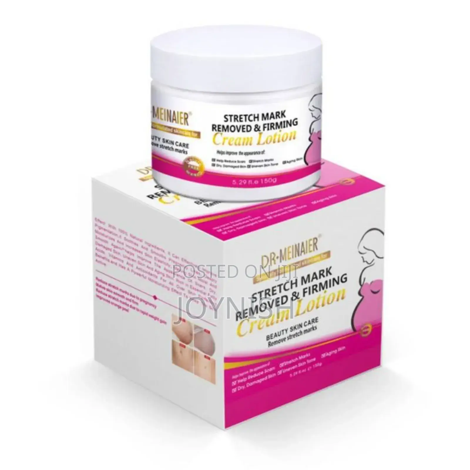 Stretch Mark Cream