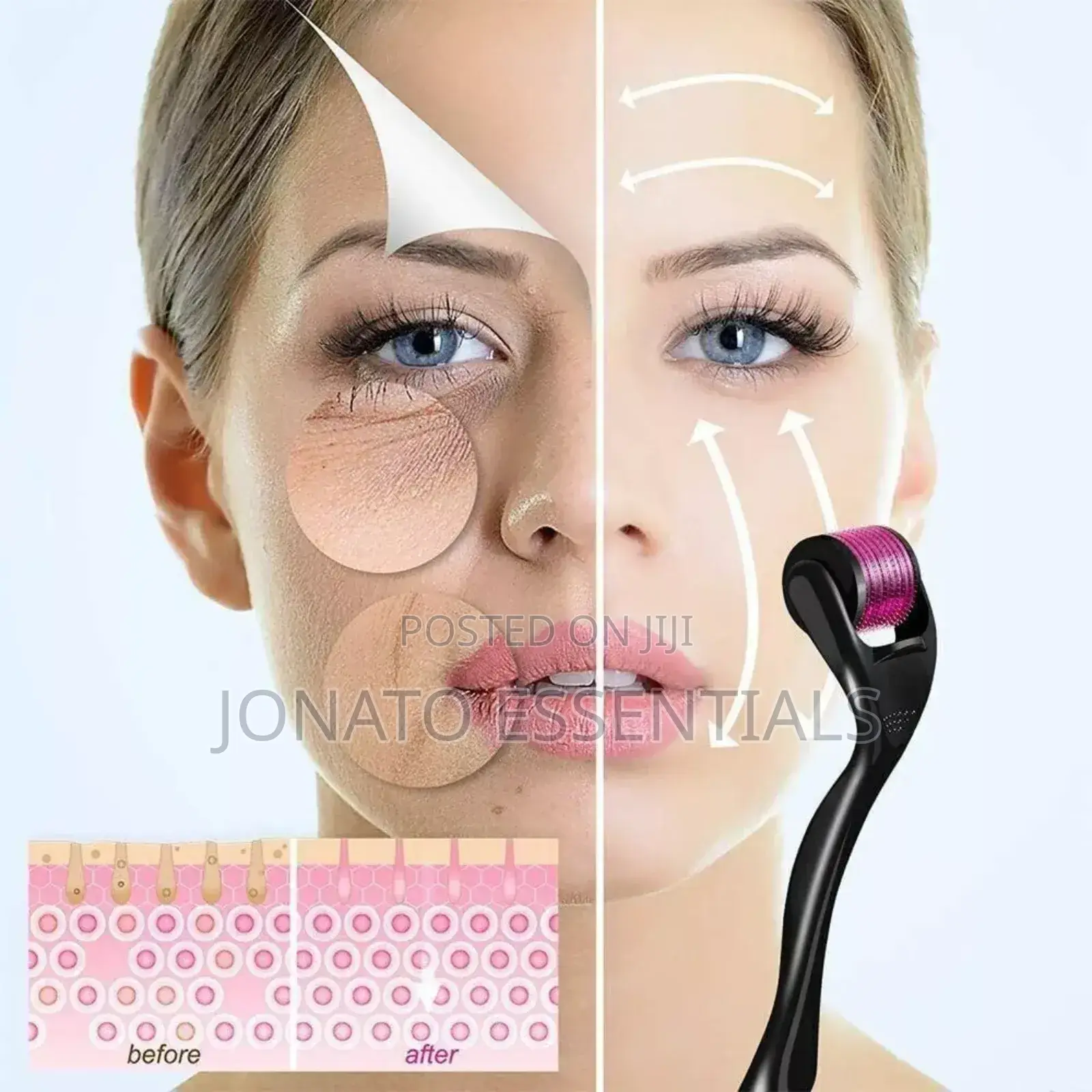 Derma Roller Microneedling Kit for Acne Scars Anti-Aging