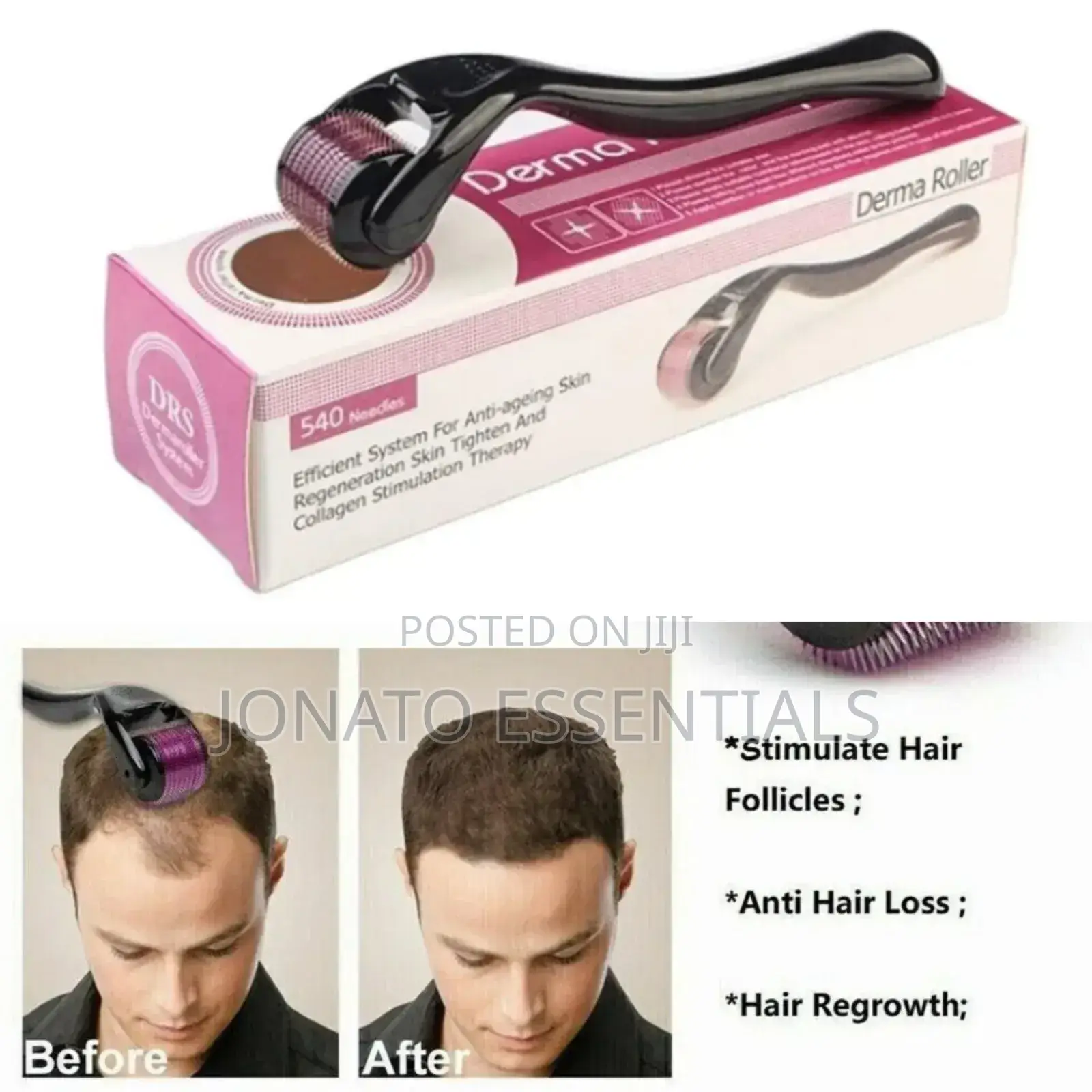 Derma Roller for Hair Growth, Beard Skin Care, Microneedle