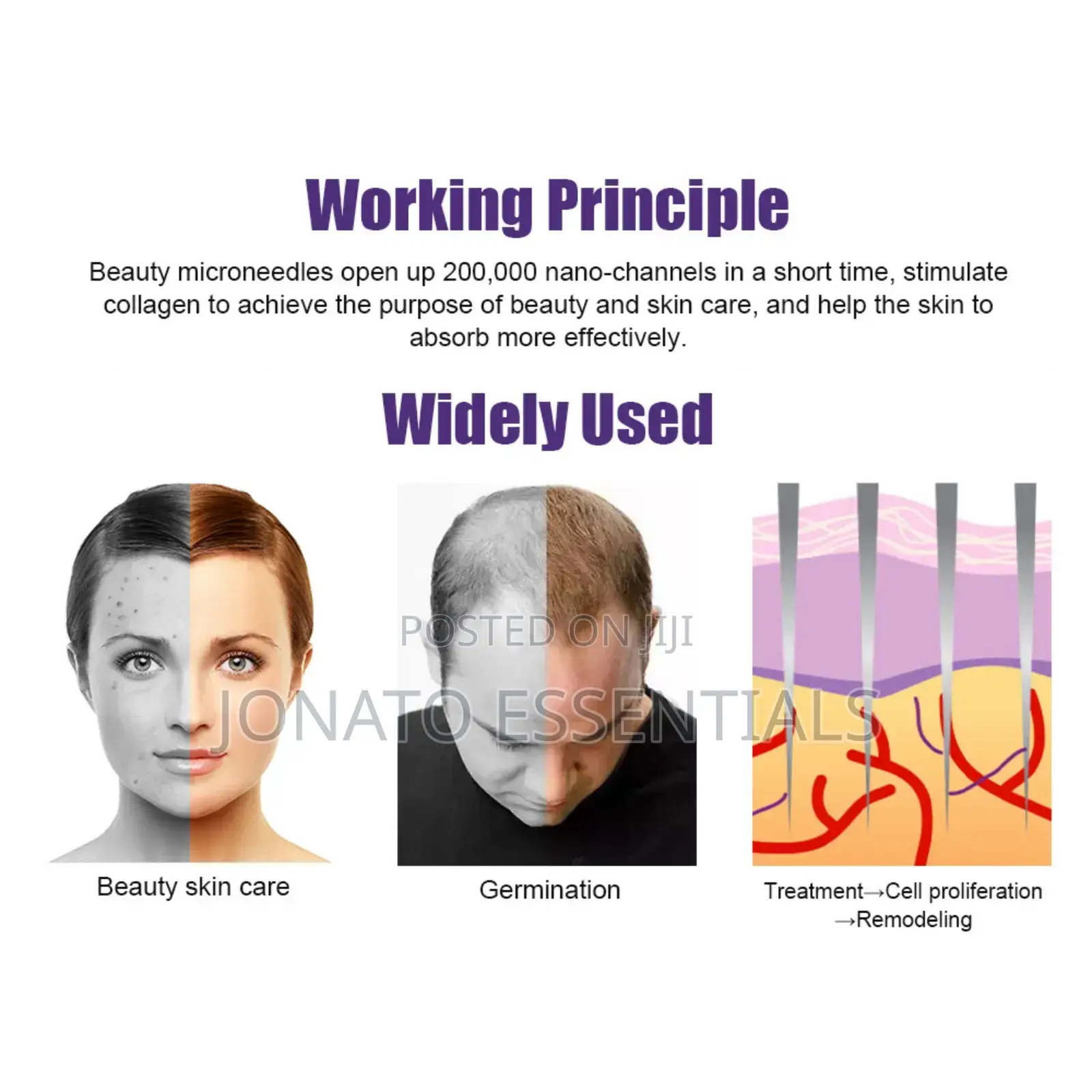 Derma Roller for Hair Growth, Beard Skin Care, Microneedle