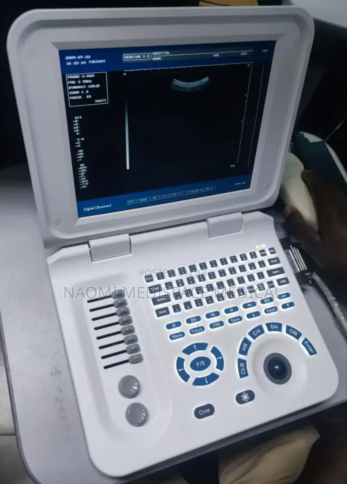 Ecomed Black and White Ultrasound With Printer