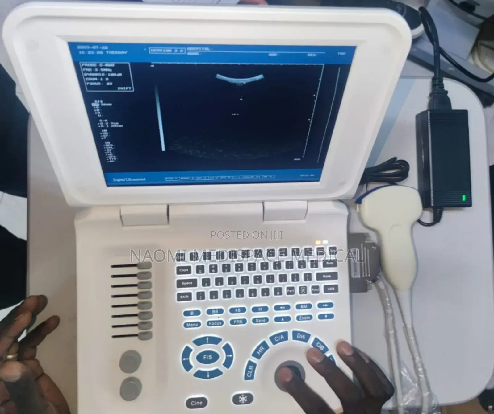 Ecomed Black and White Ultrasound With Printer