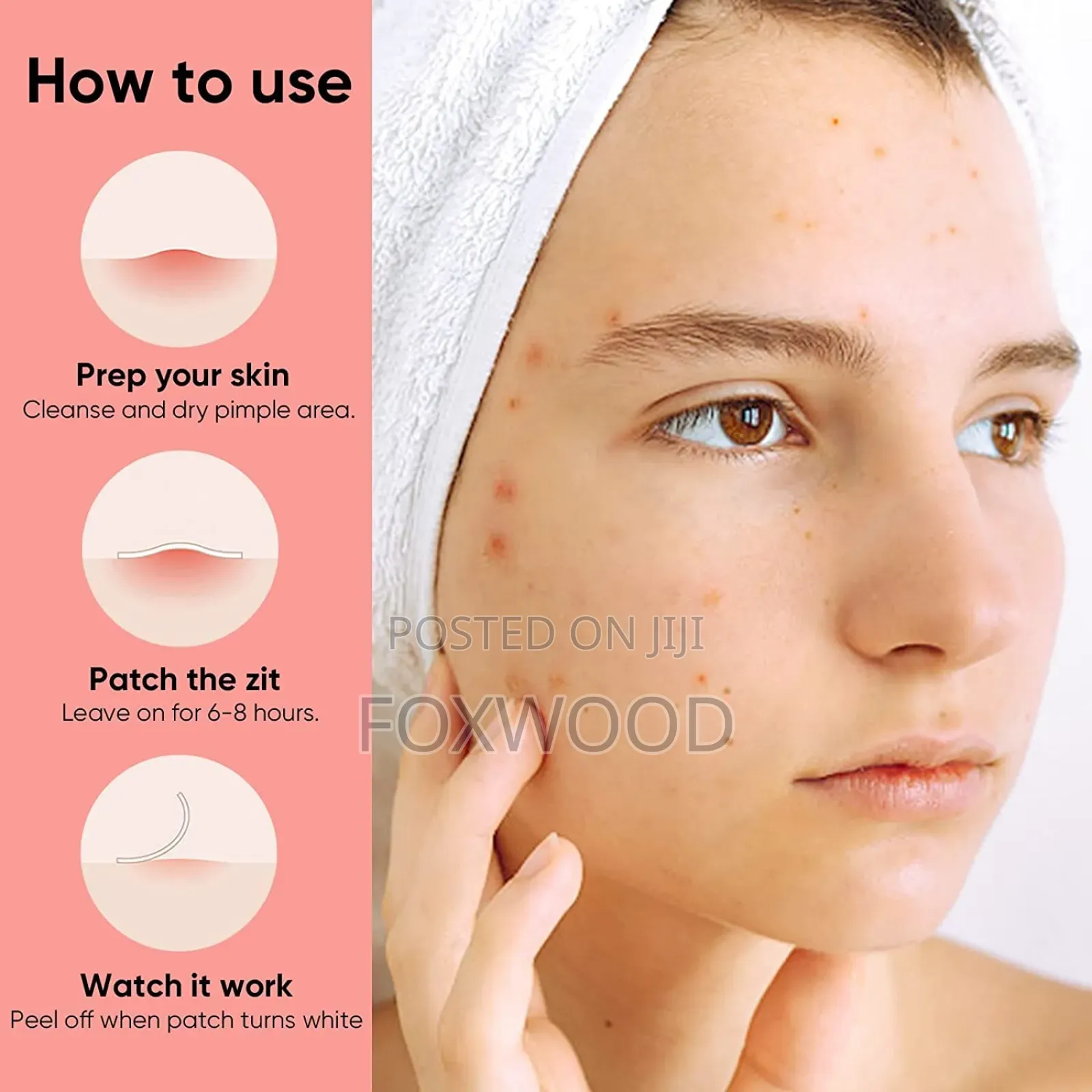 Acne Pimple Patch (36 Patches)