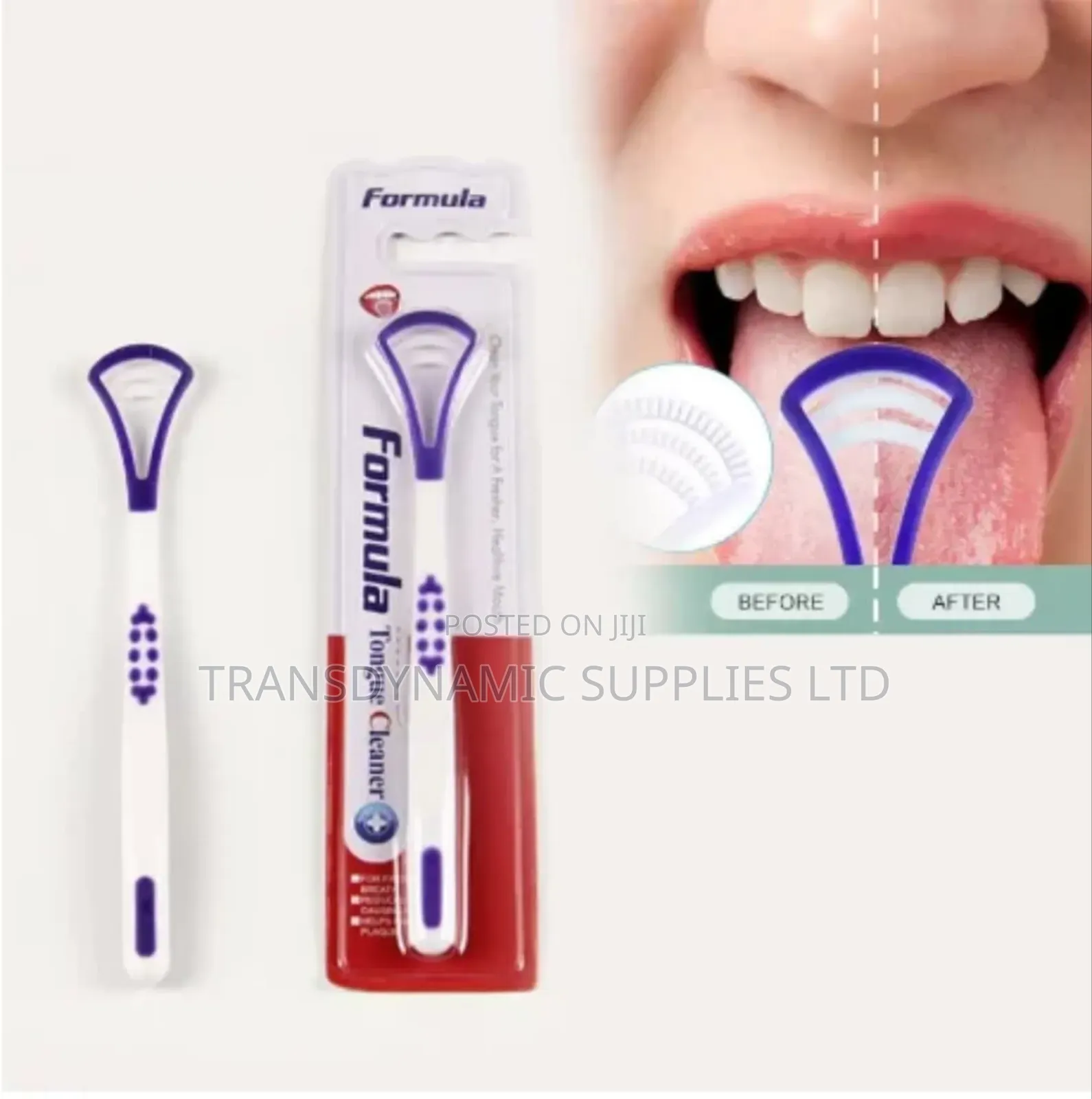 Tongue Cleaner