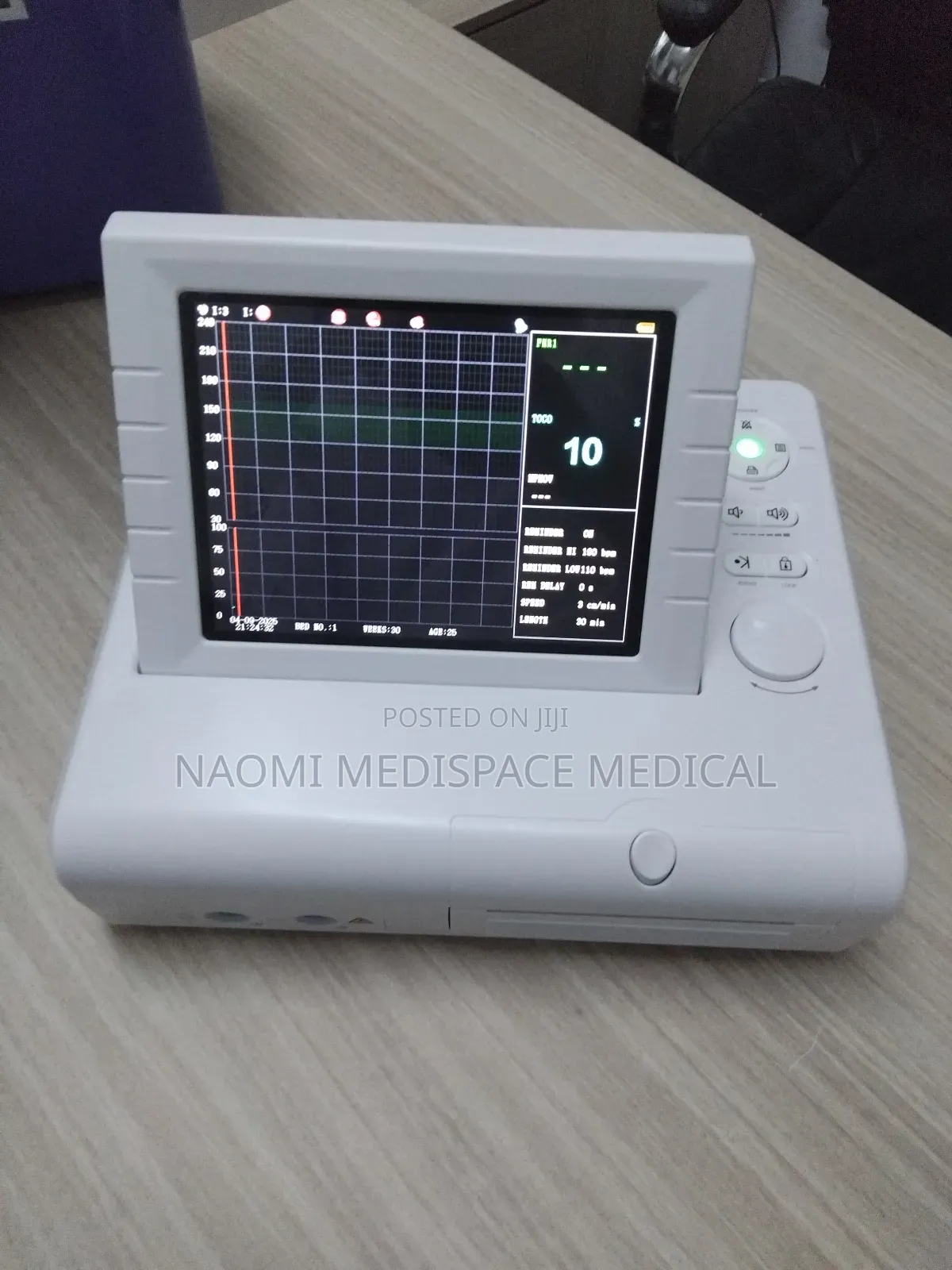 CTG Machine-Cardiotocograph