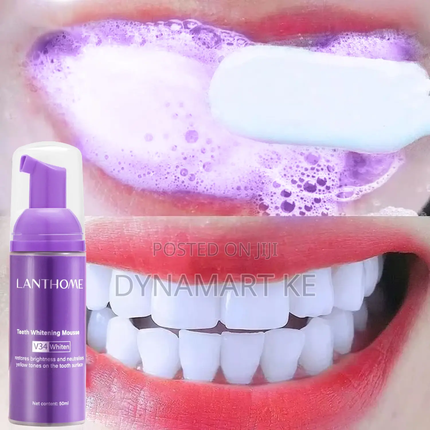 Lanthome V34 Teeth Whitening and Stain Remover Colour Corrector