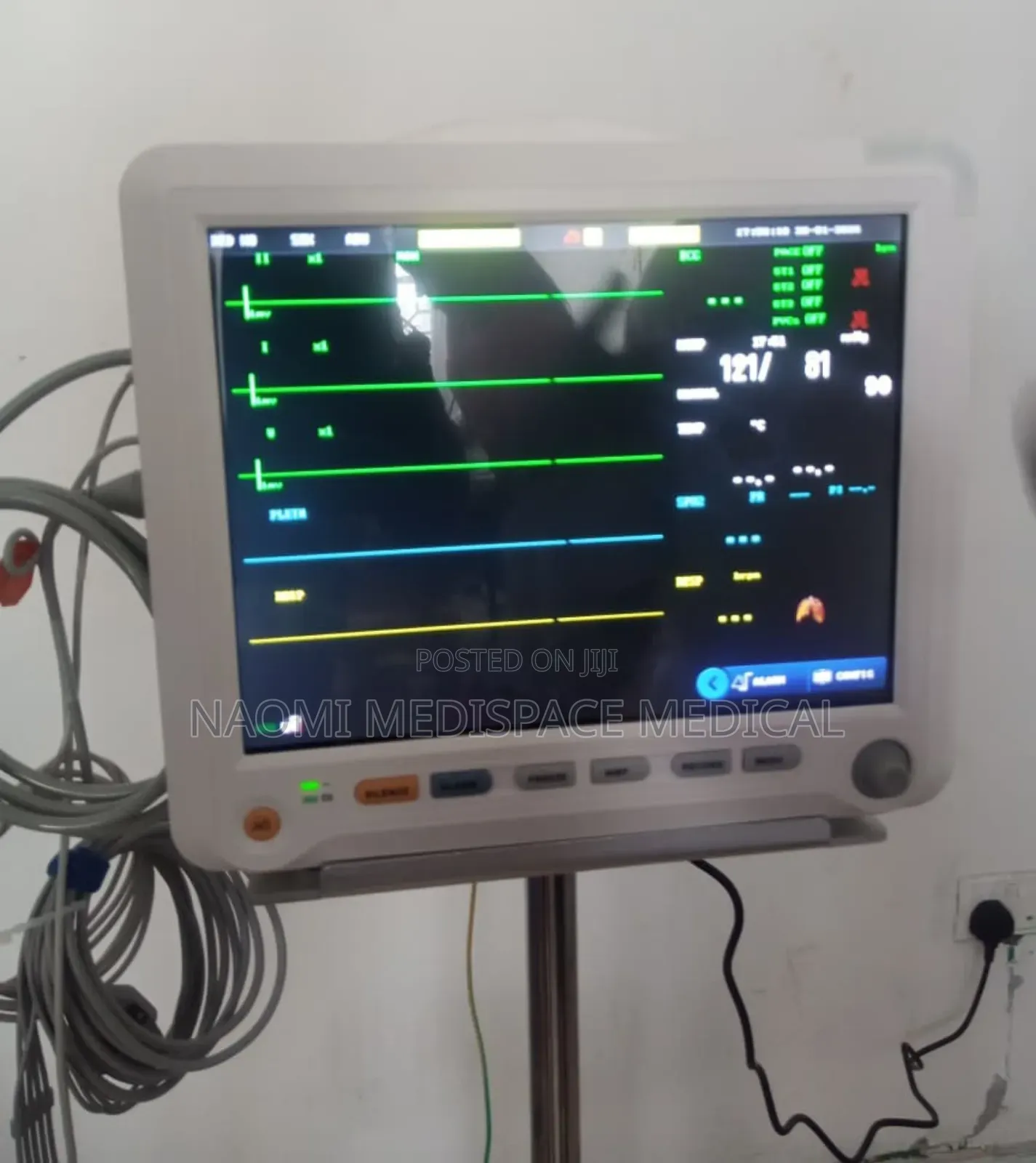 Patient Monitor Yonker 5 Parameters