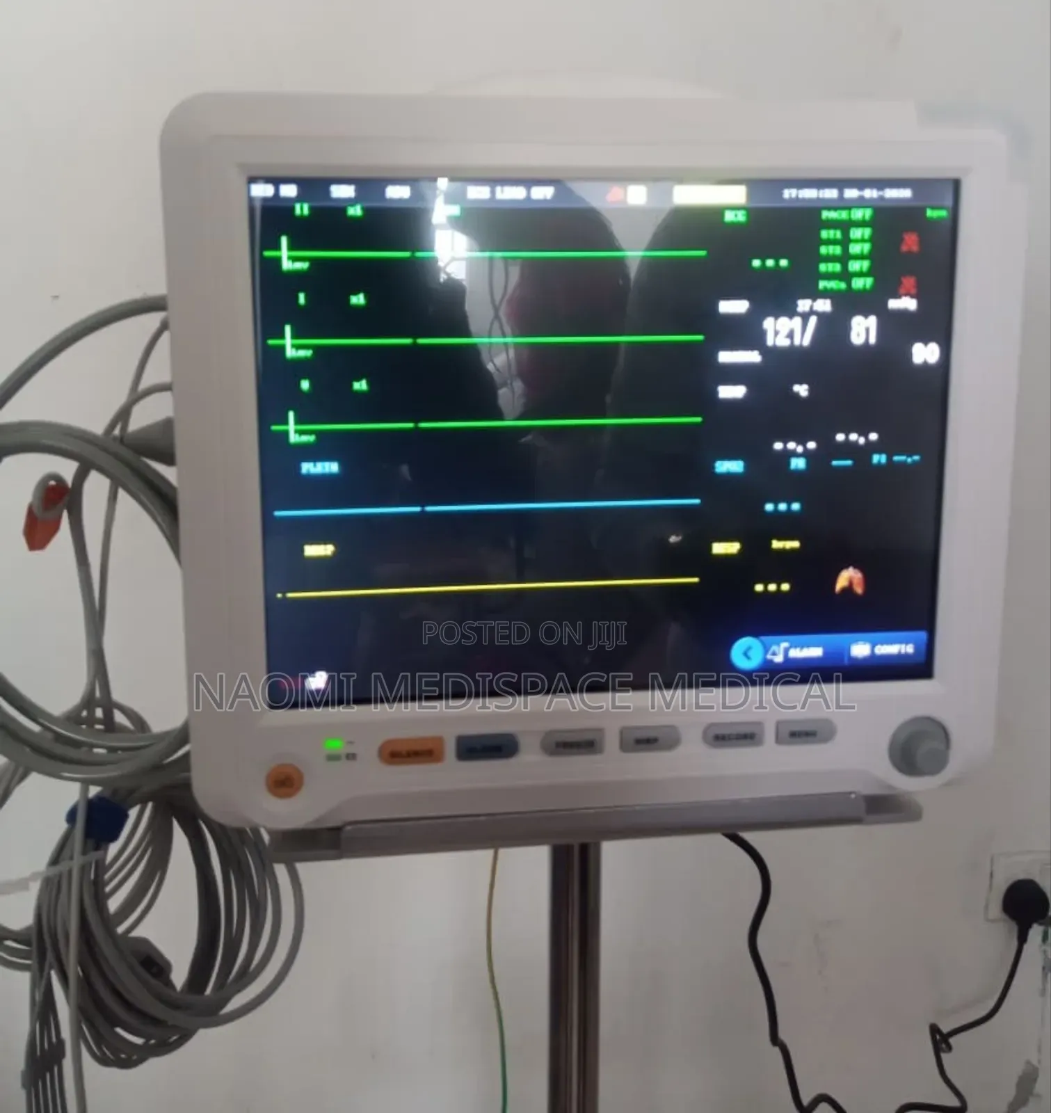 Patient Monitor Yonker 5 Parameters