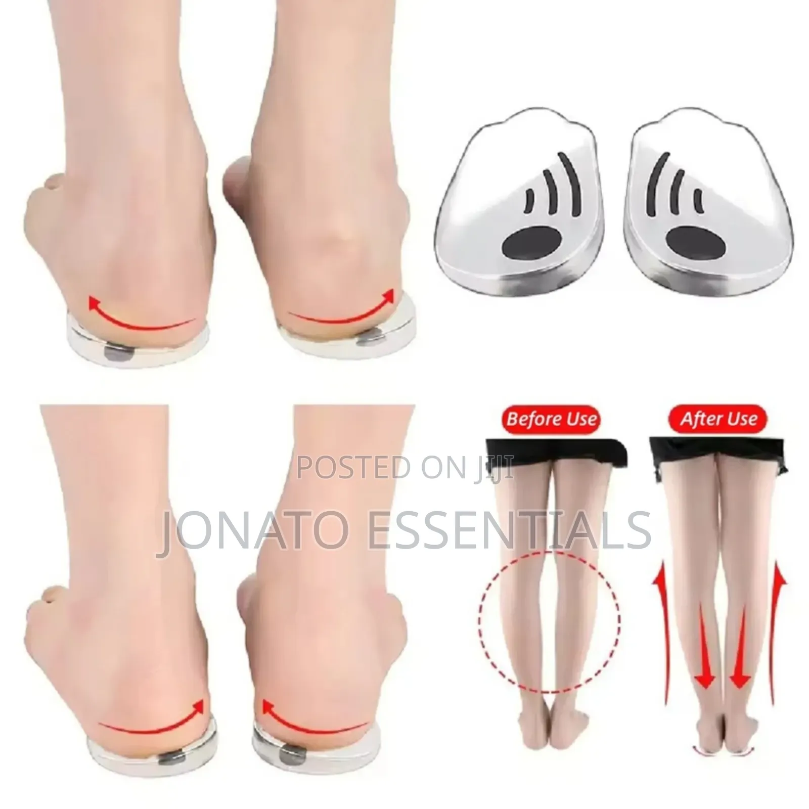Orthopedic Silicone Heel Insoles for O/X Leg Correction