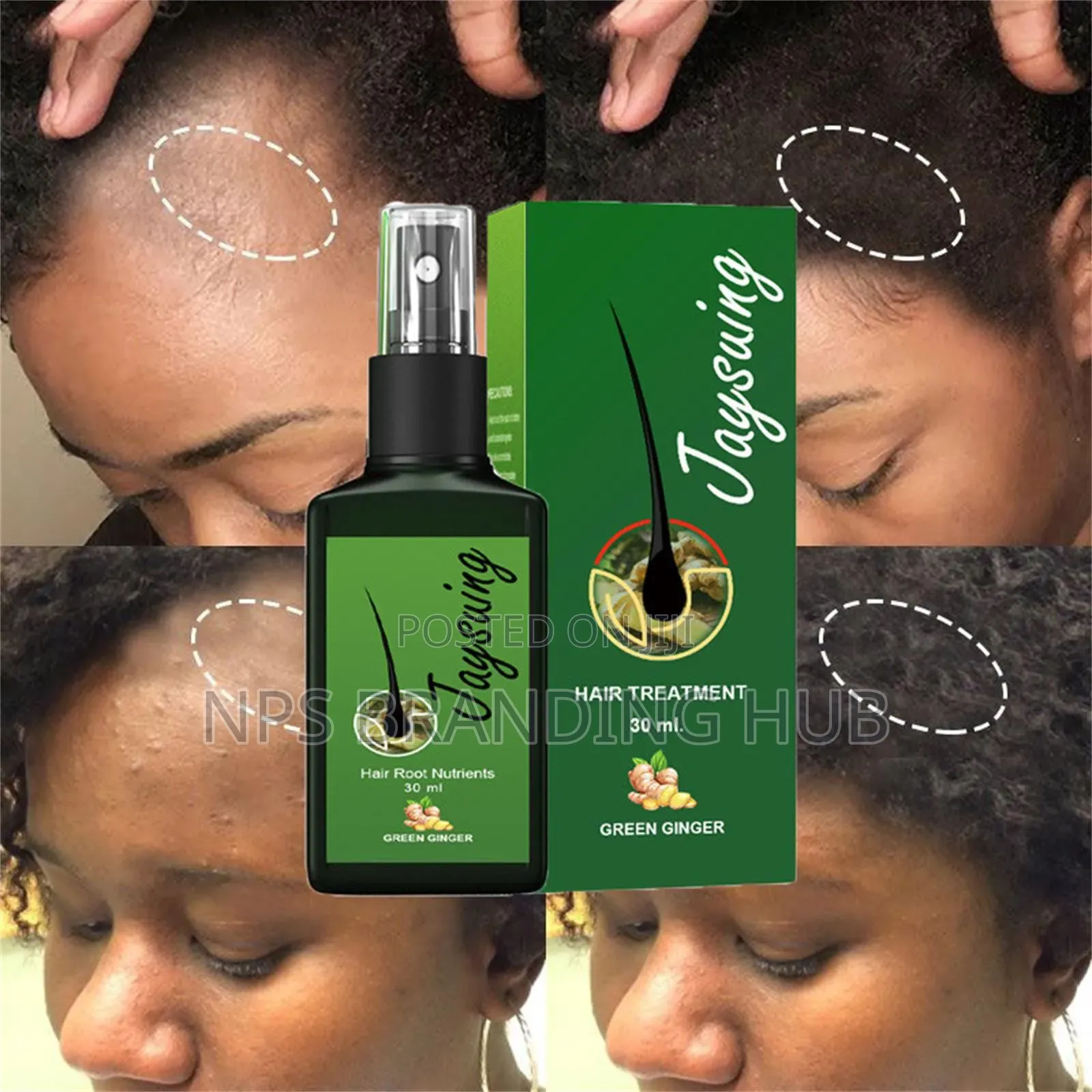 Original Thailand Jaysuing Hair Lotion Cn