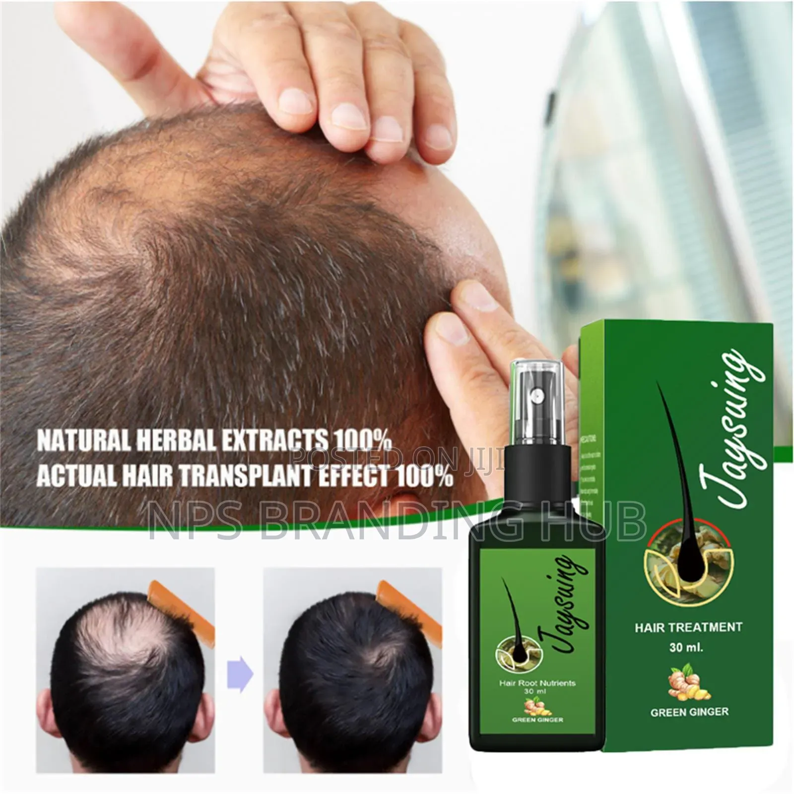 Original Thailand Jaysuing Hair Lotion Cn