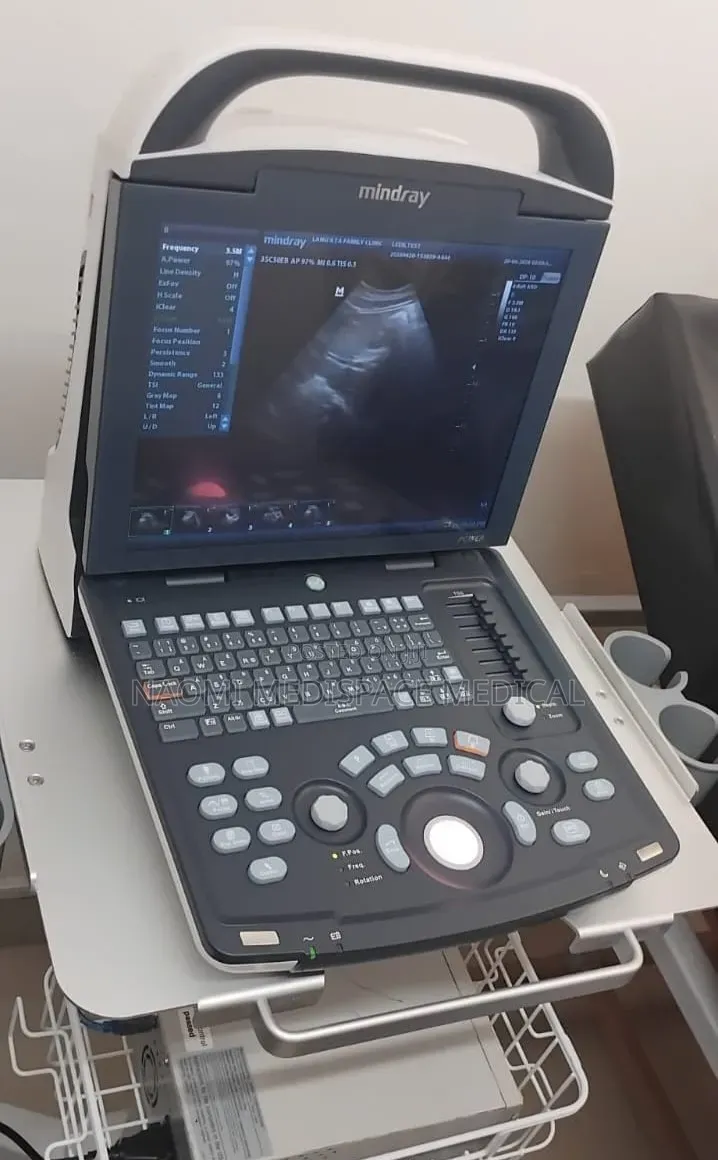 Portable and Lightweight Ultrasound Machine (Mindray Dp 10)**
