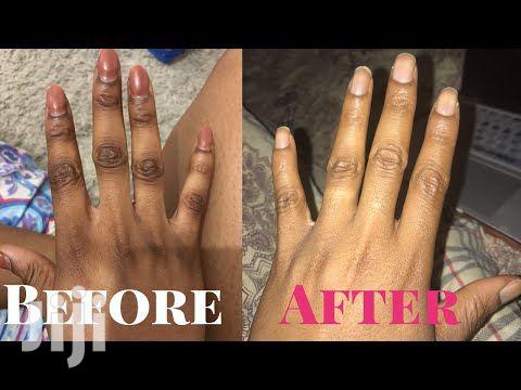 Chlonovate Whitening Cream