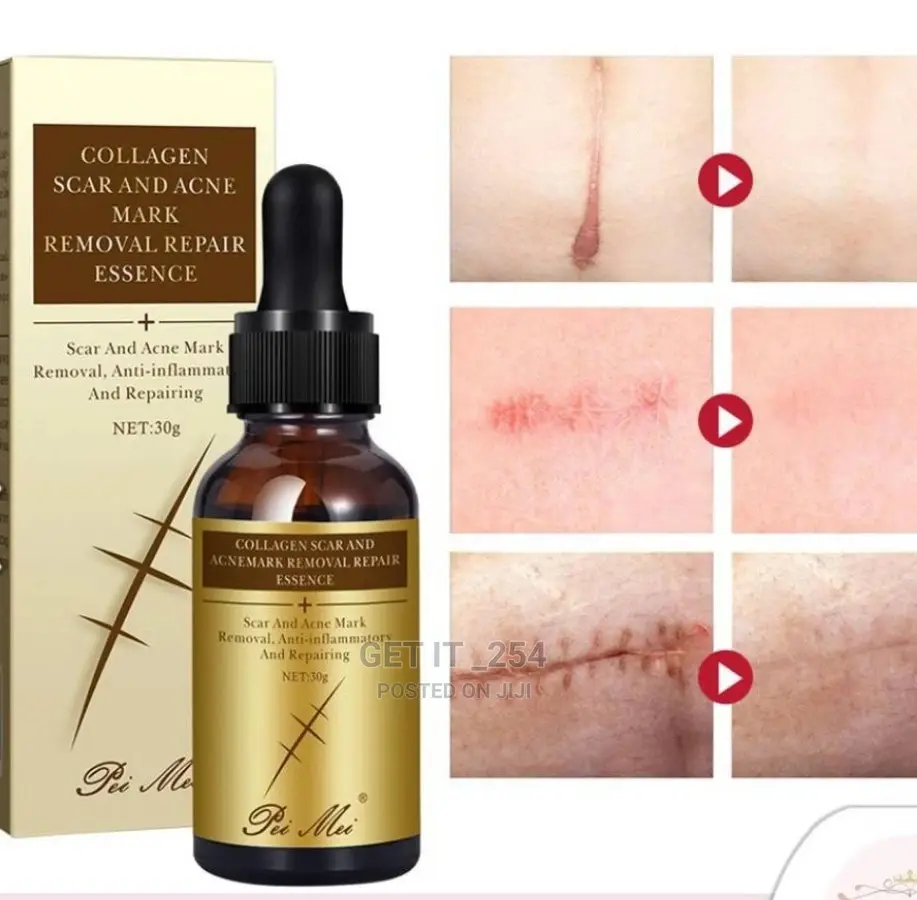 Scar and Dark Spots