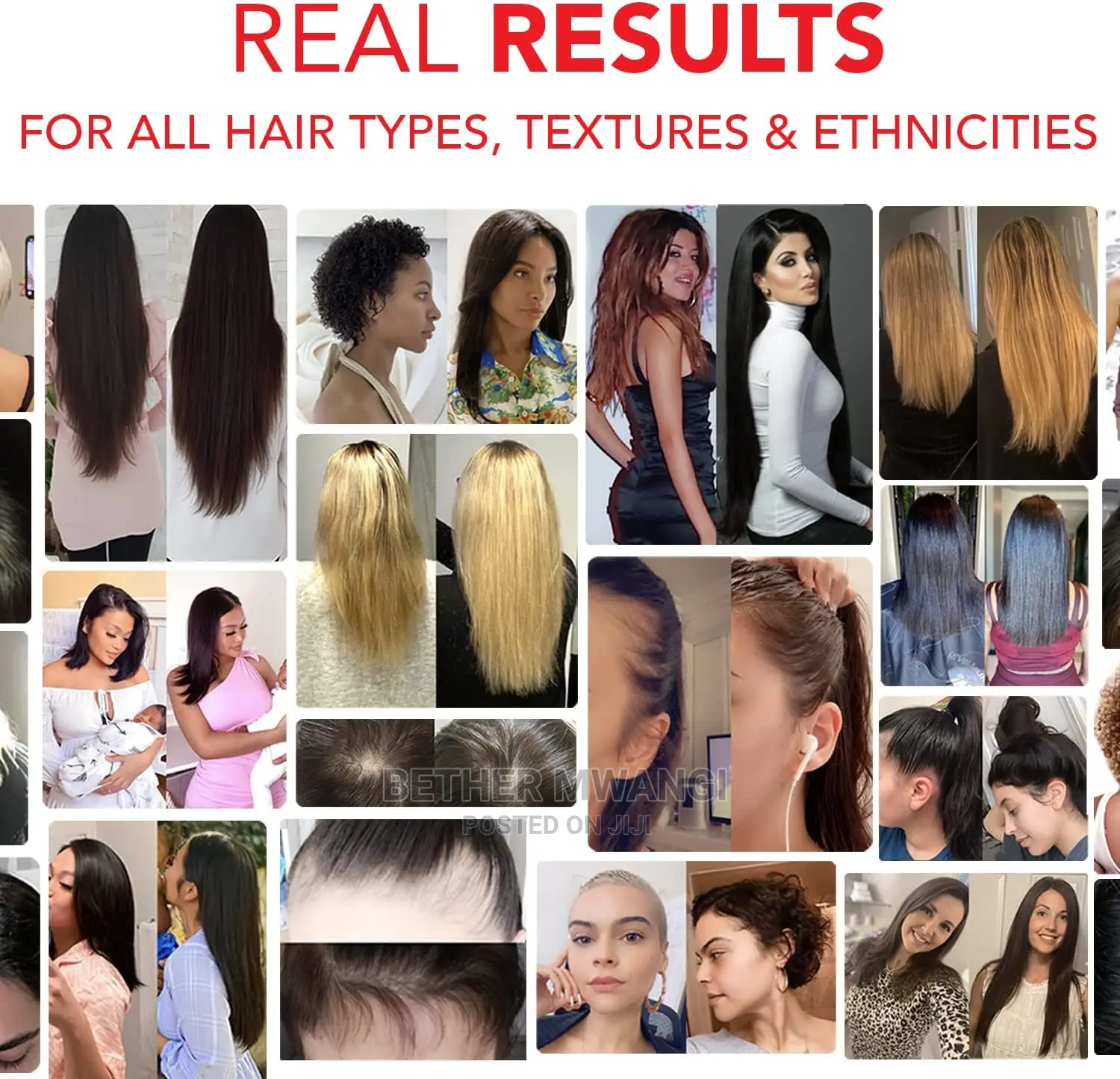 Hairtamin Hair Product for Faster Hair Growth
