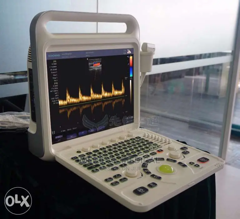 Color Doppler Ultrasound
