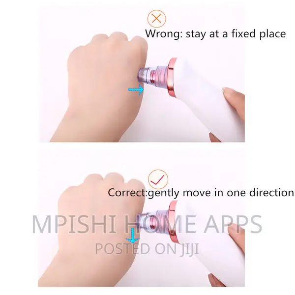 Microcrystalline Blackhead Remover