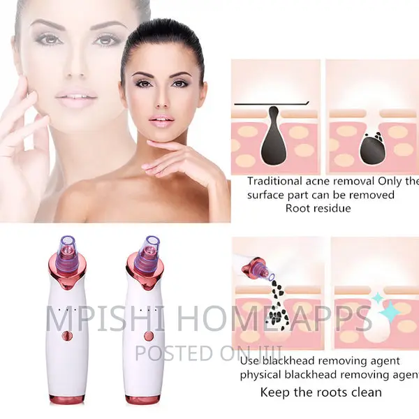 Microcrystalline Blackhead Remover