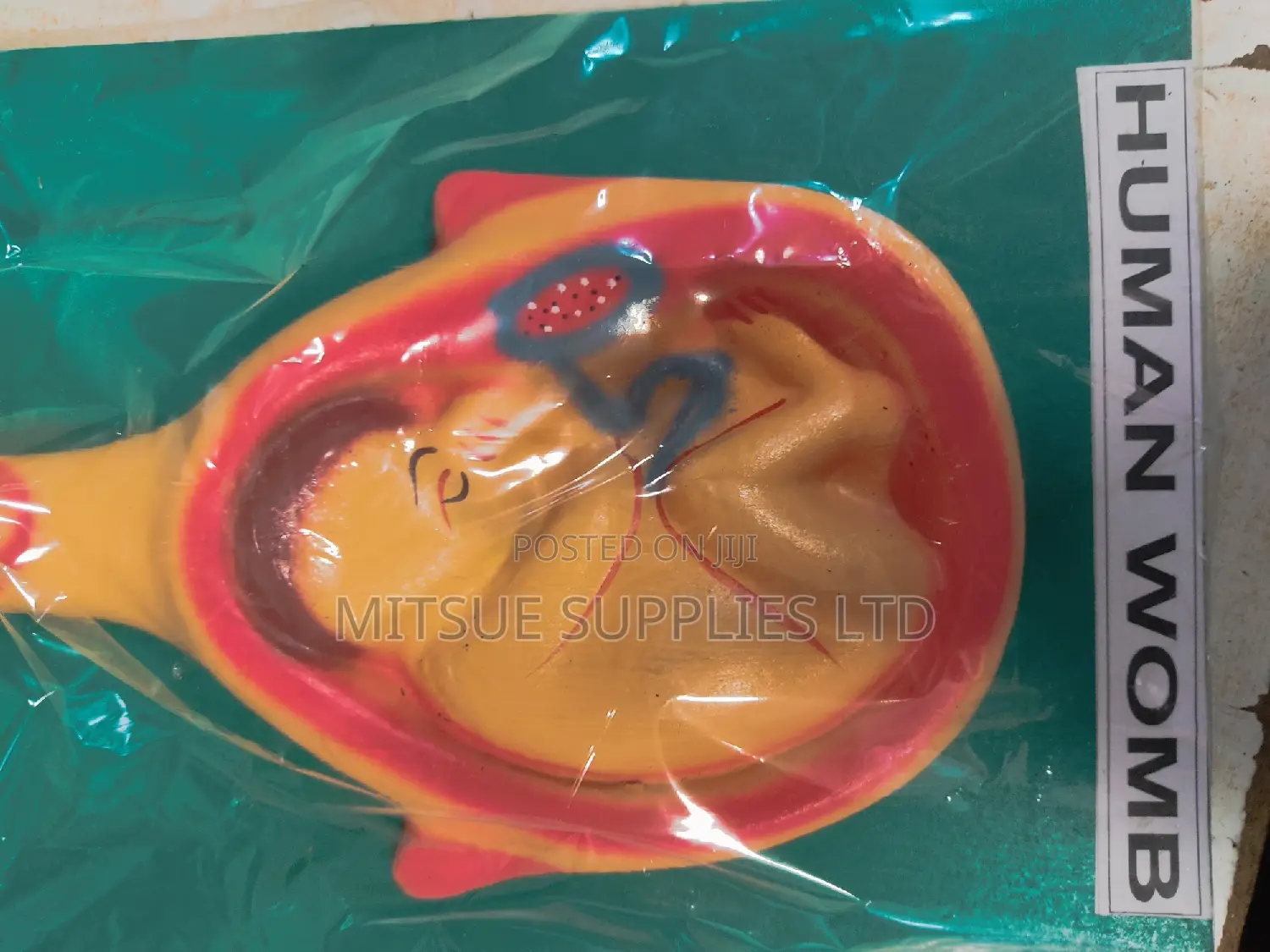 Model of Woman Womb General Detail