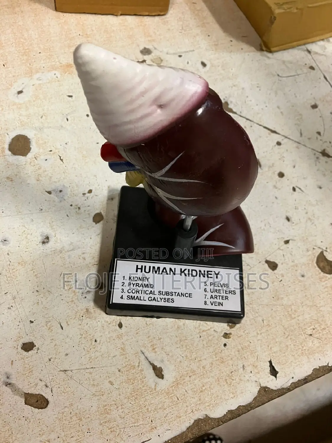 Model Human Kidney on Stand