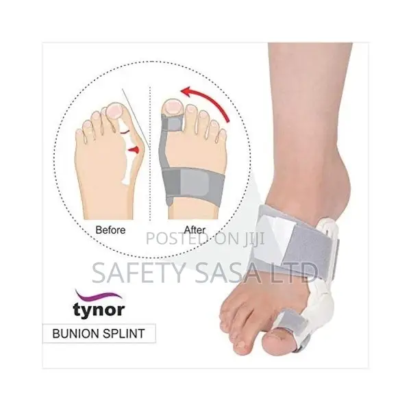 Tynor One Piece Bunion Splint