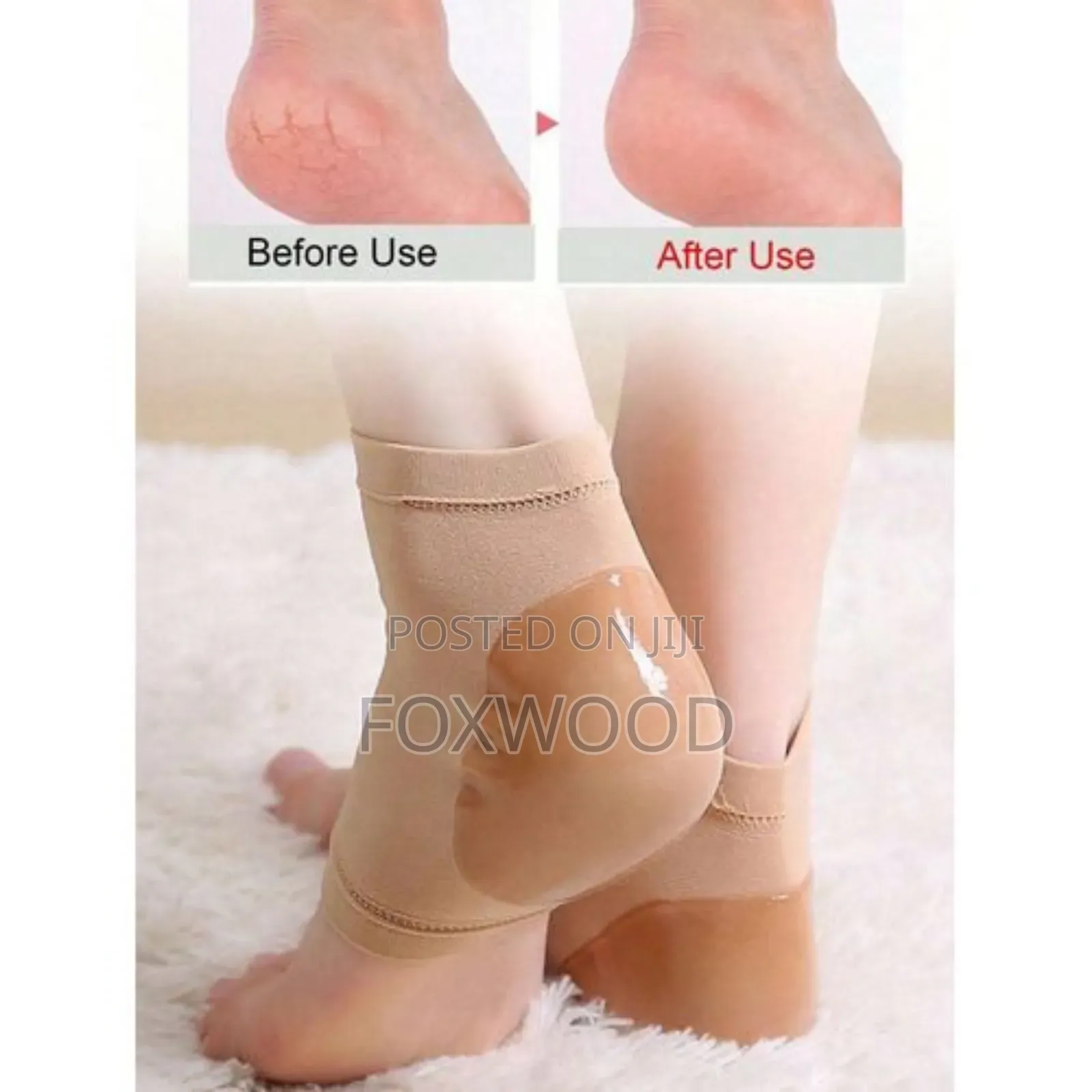 Anti Cracking Heel Sleeves Pair