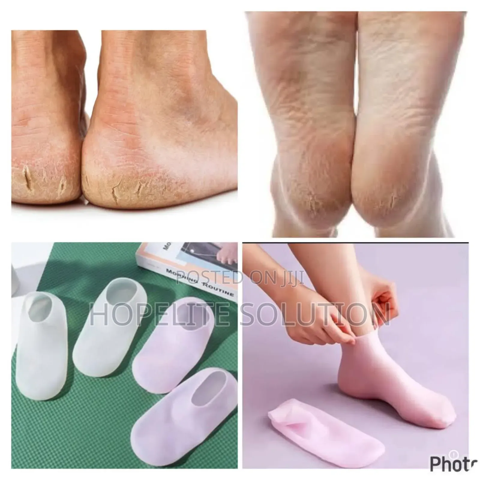 Silicon Moisturing Gel Socks