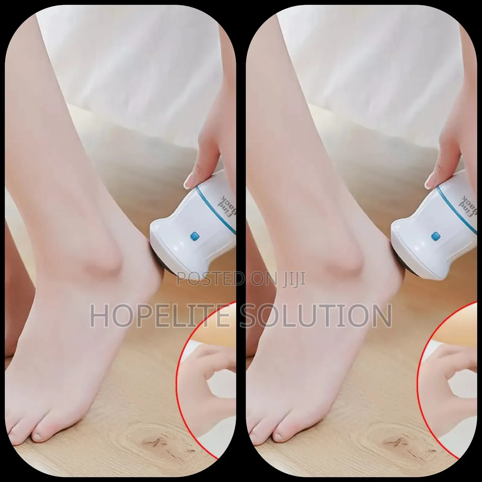 Foot File , Callous Remover