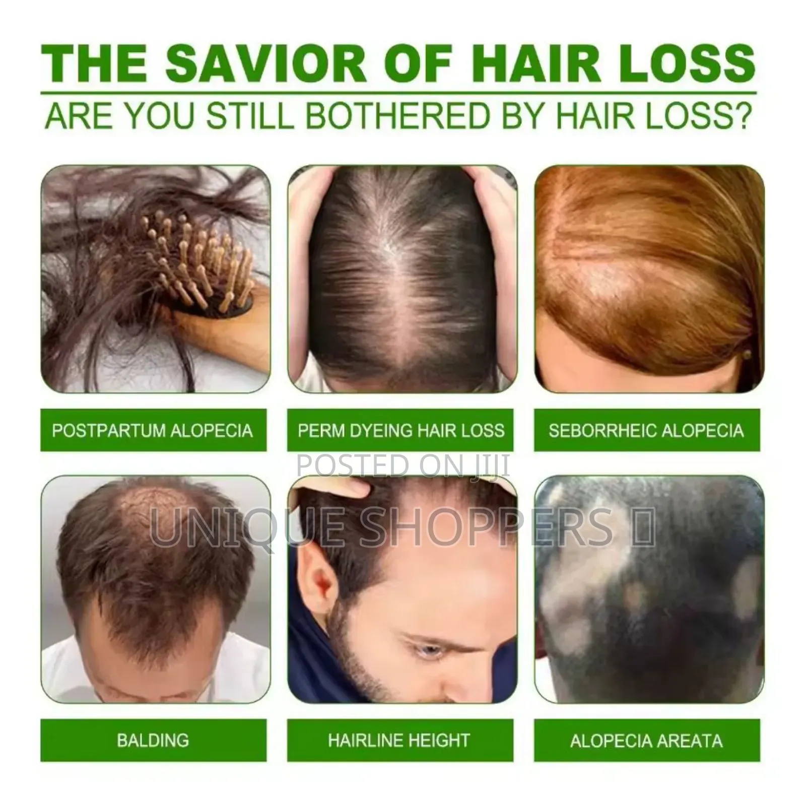 Anti Hair Loss Cream