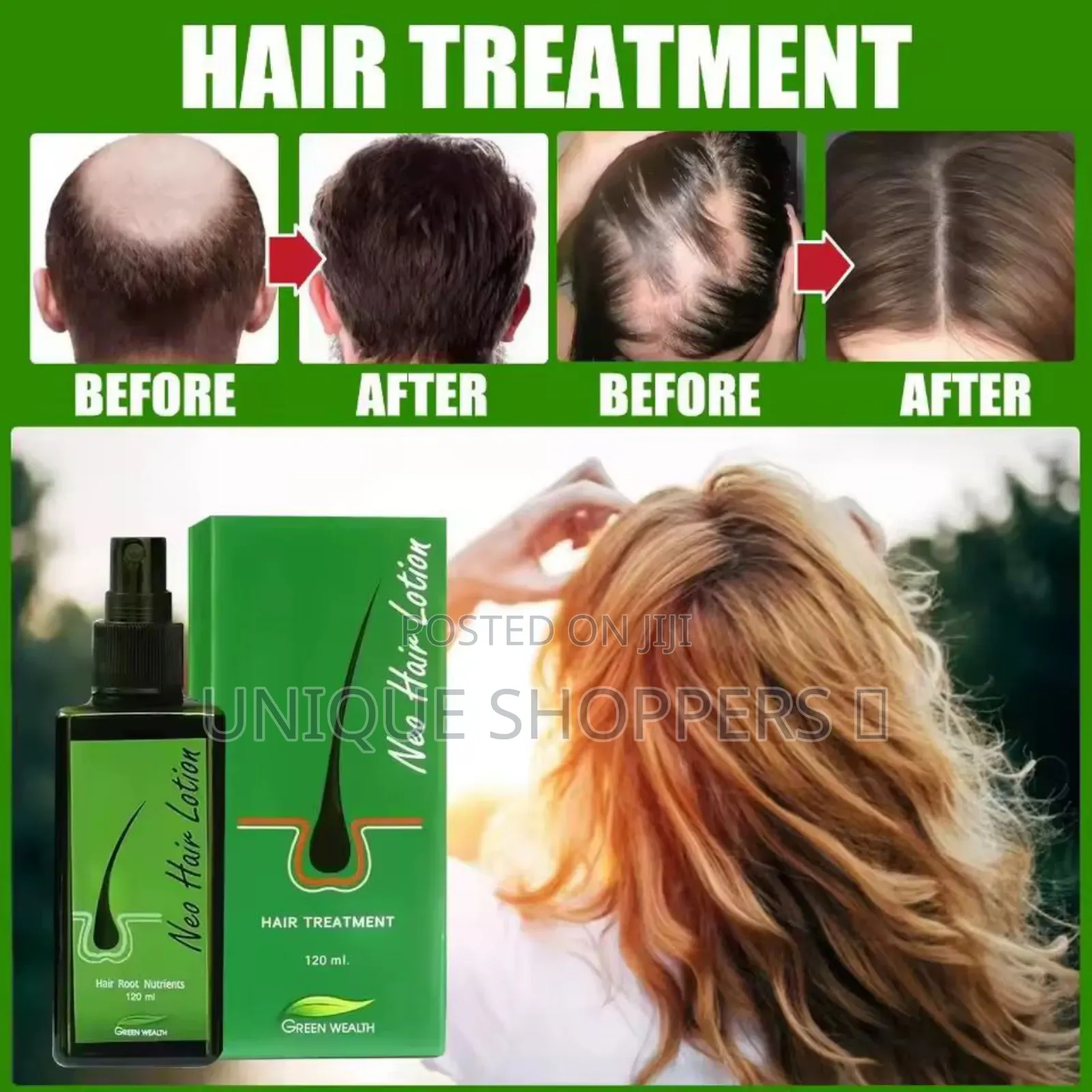 Anti Hair Loss Cream