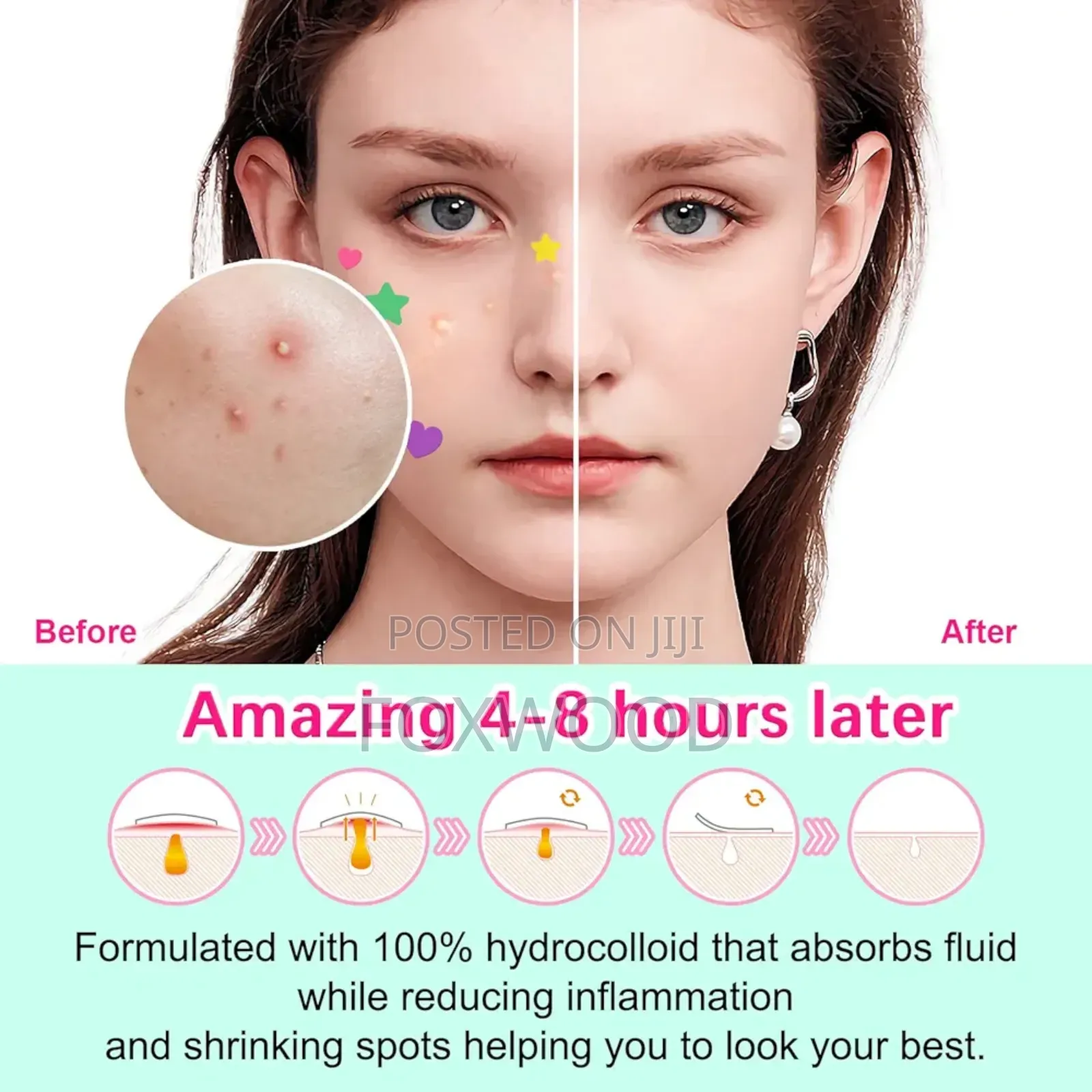 Elaime Star+Heart Acne Patches.