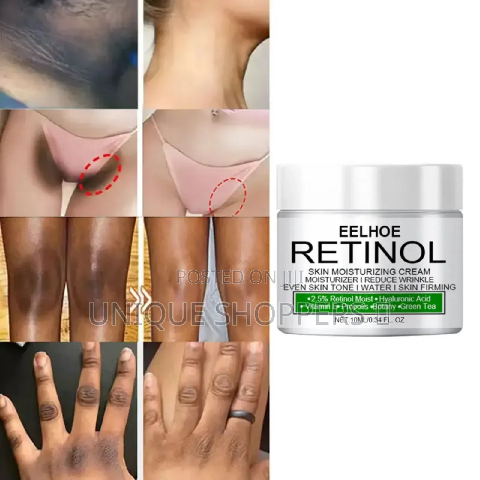 Body Whitening Cream Underarm Knee Buttocks Private Bleach Remove Mela