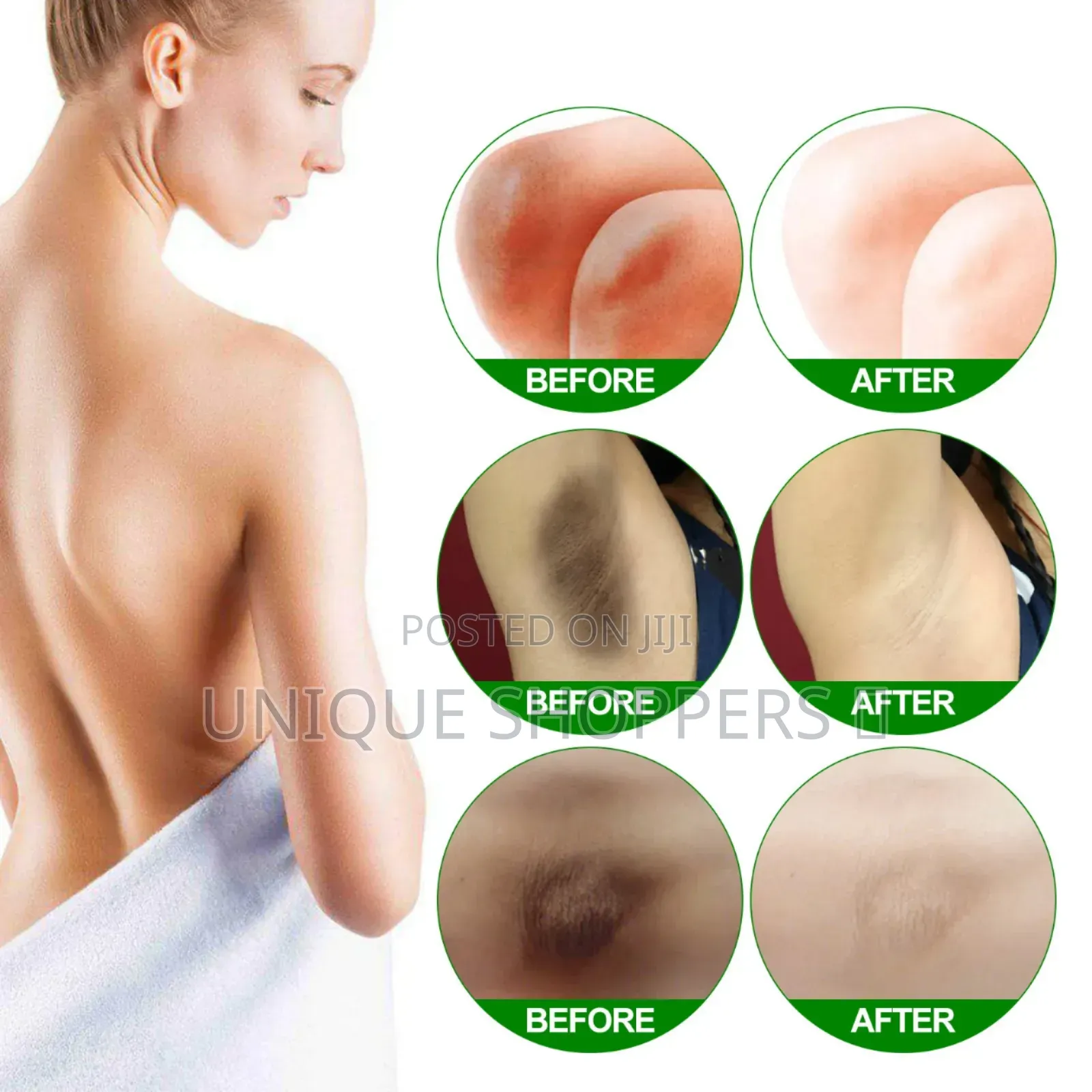 Body Whitening Cream Underarm Knee Buttocks Private Bleach Remove Mela