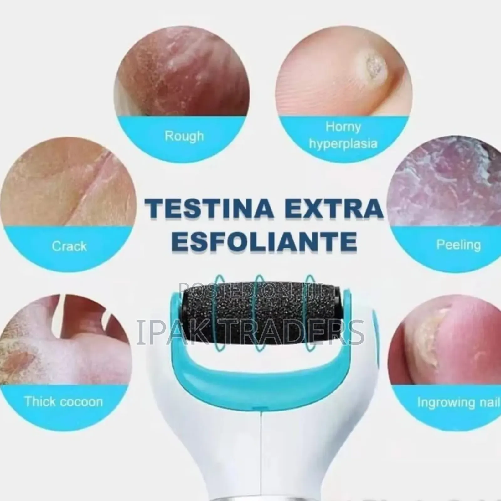 *The Secret Cordless Electric Callus Remover