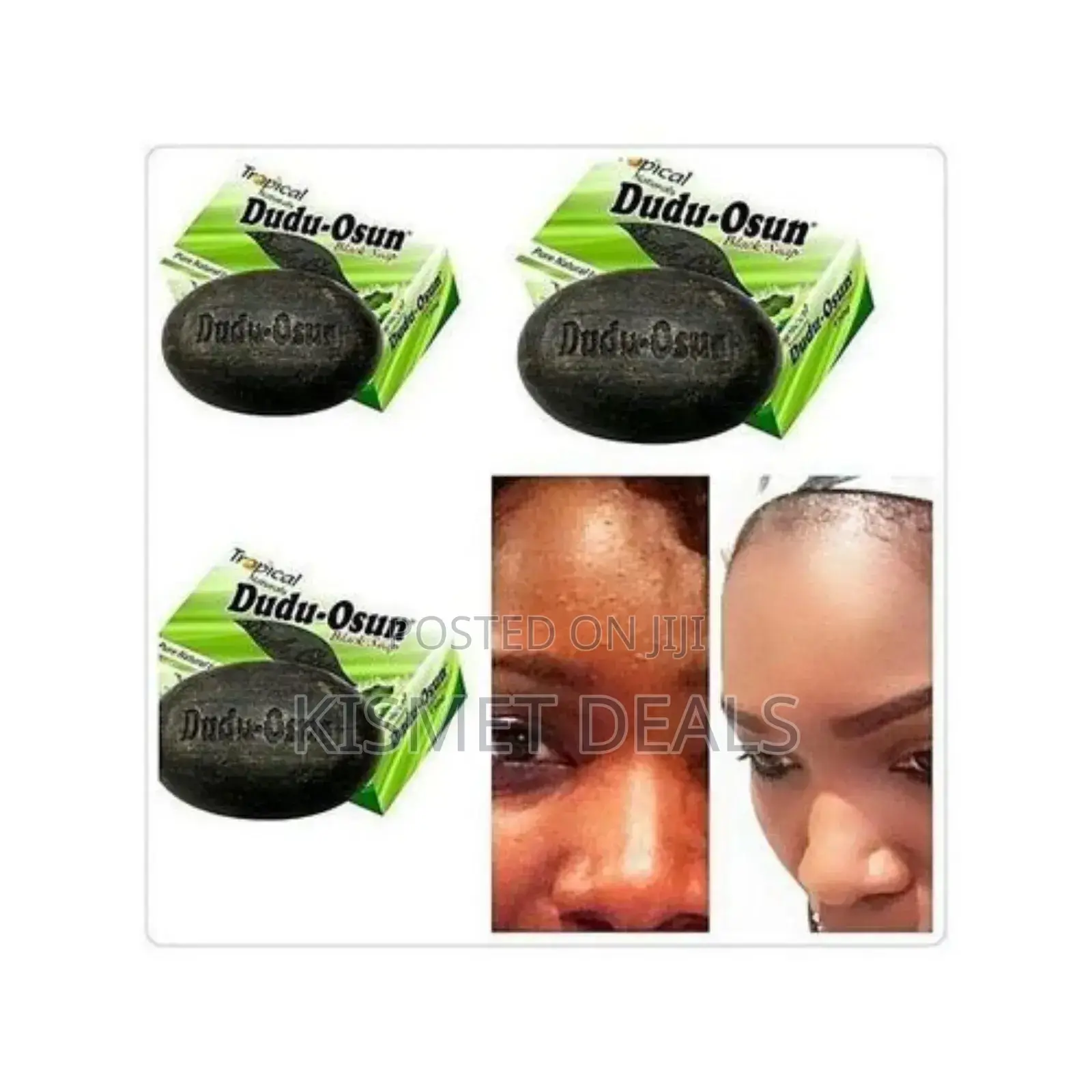 Dudu Osun Antibacterial Black Soap for Dark Spots Blemishes