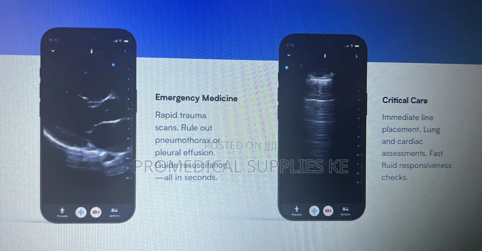 Butterfly Iq3 Pocus