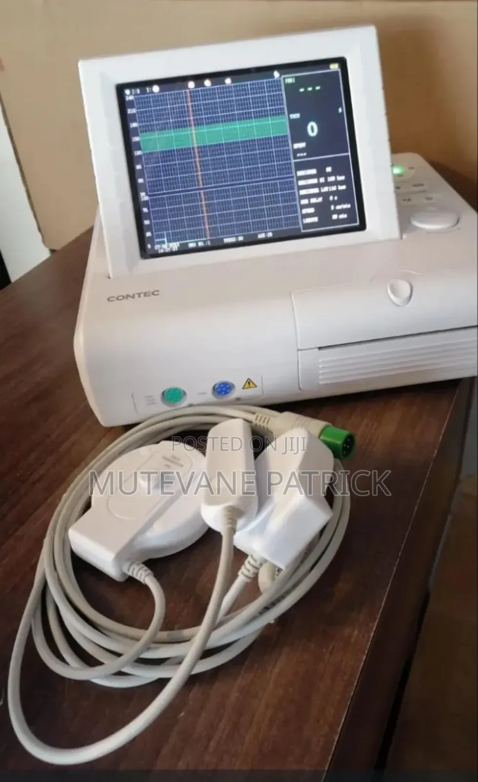 Cardiotocograhy (Ctg) Machine
