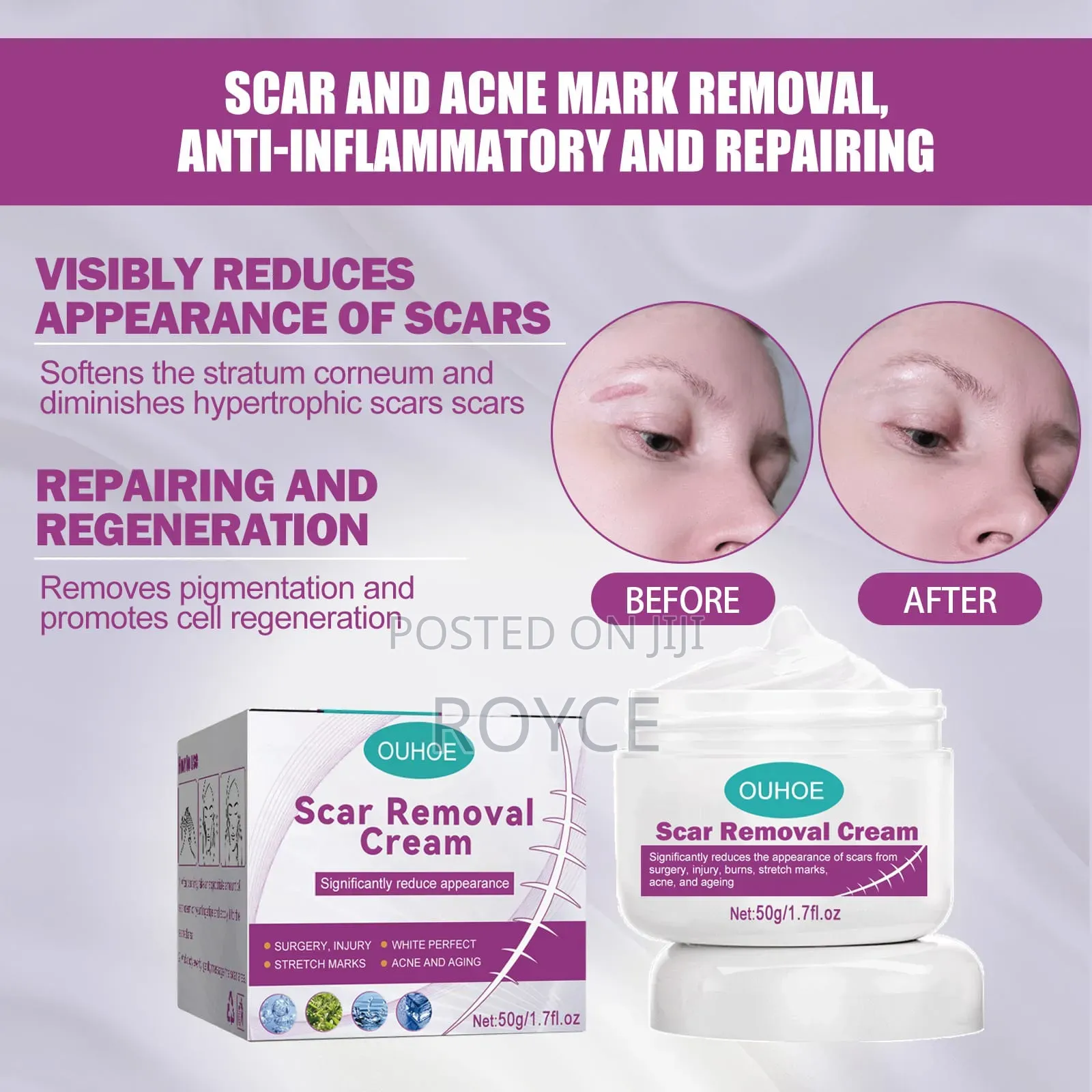 Scar Removal Cream
