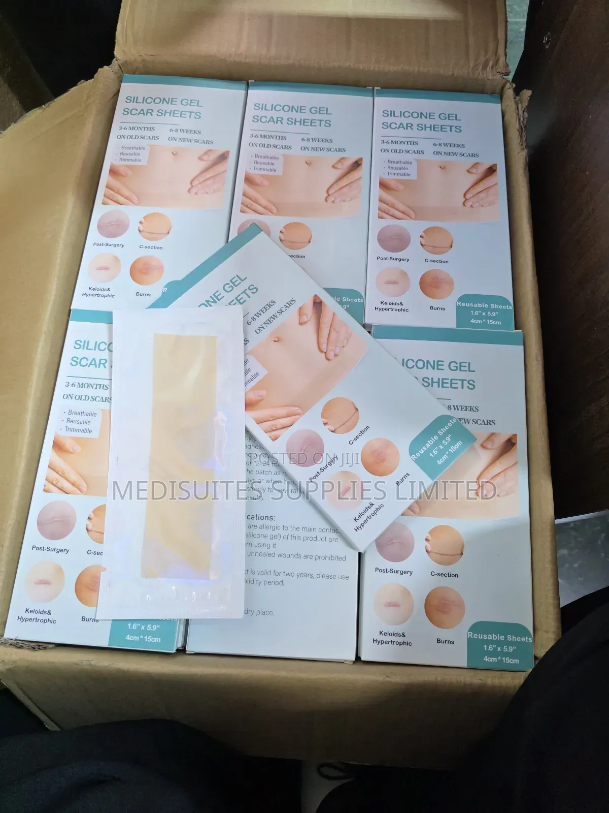 Silicone  Scar Sheet