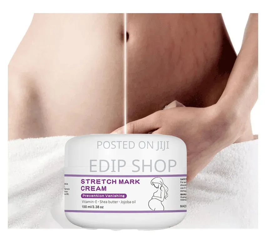 Stretch Mark Cream