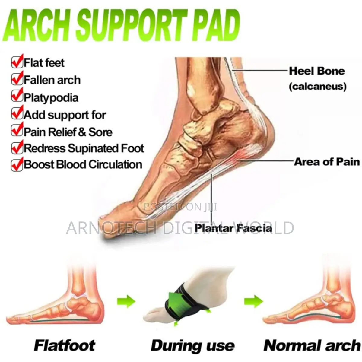 Plantarfix Arch Support for Flat Feet - Pain Relief Cushion