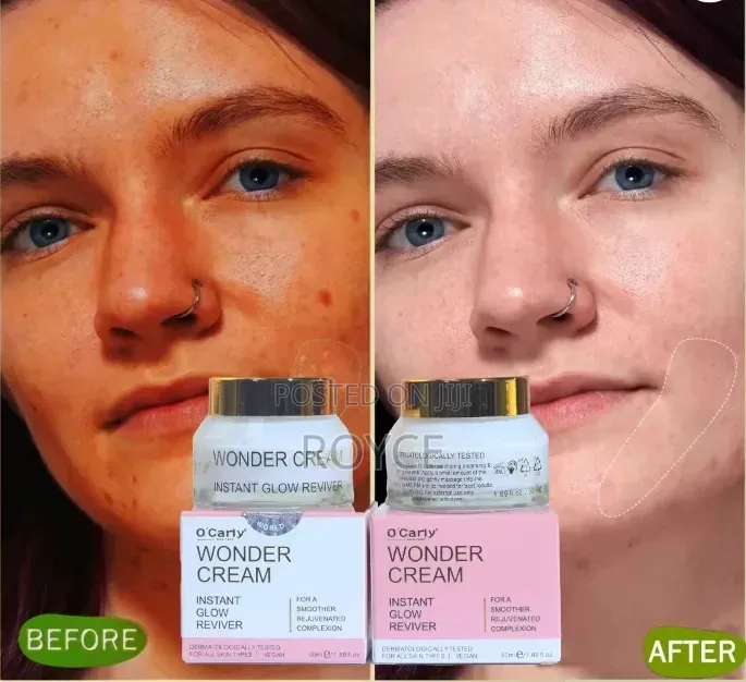 Wonder Cream